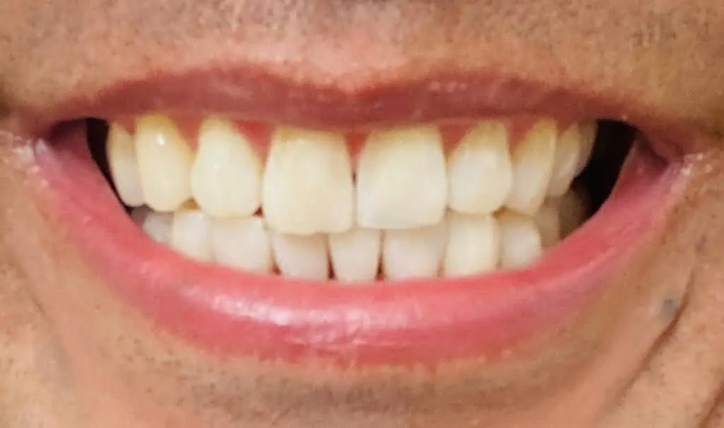 Burke Dental Center - Dr. Nabeel Khan