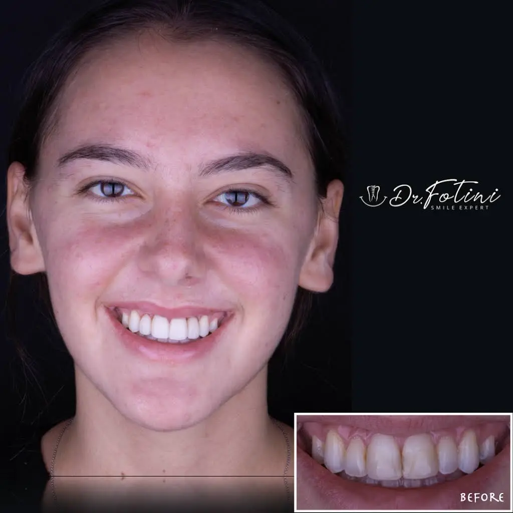 Fotini Chrisopoulos DDS, MS- Prosthodontist | Cosmetic & Implant Dentistry