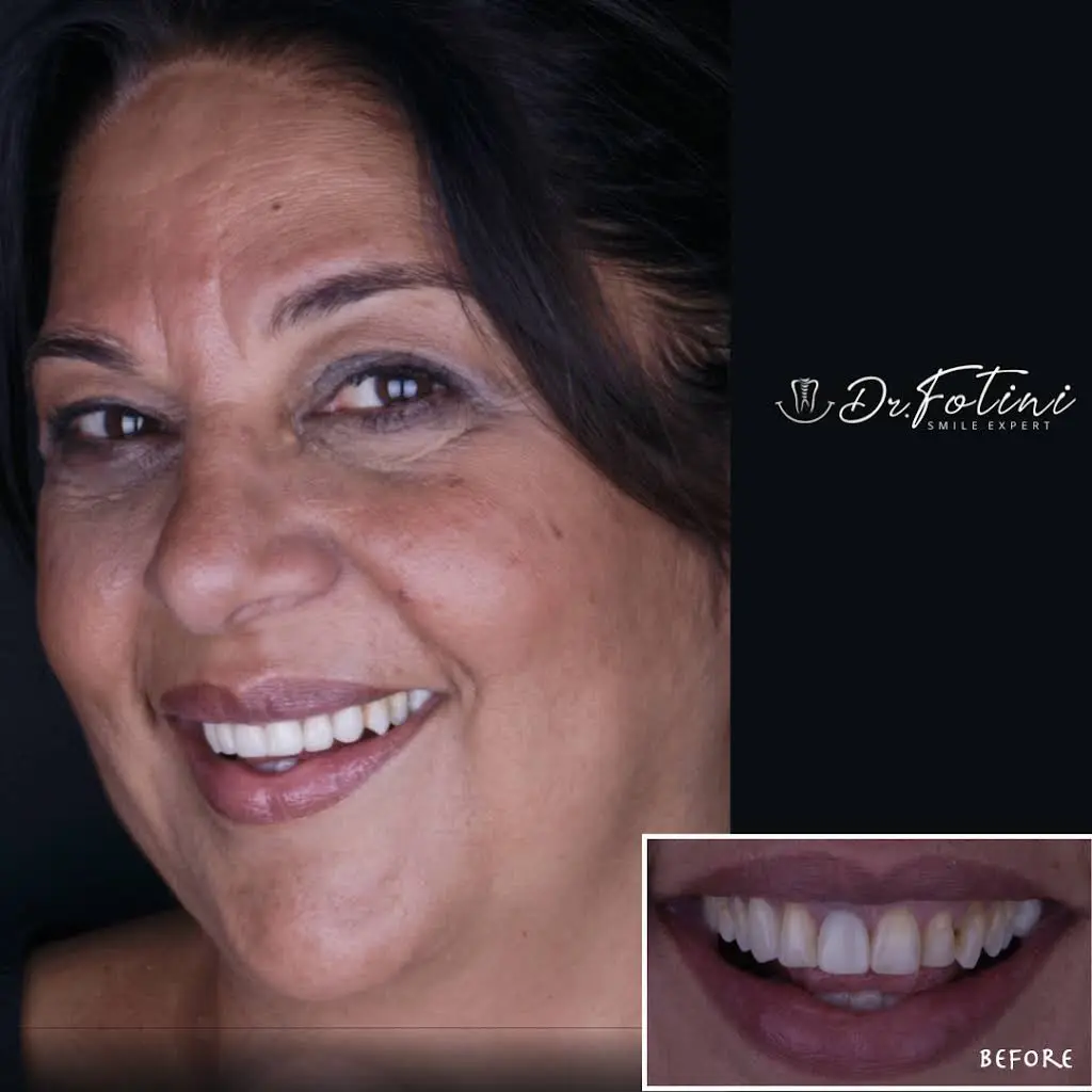 Fotini Chrisopoulos DDS, MS- Prosthodontist | Cosmetic & Implant Dentistry