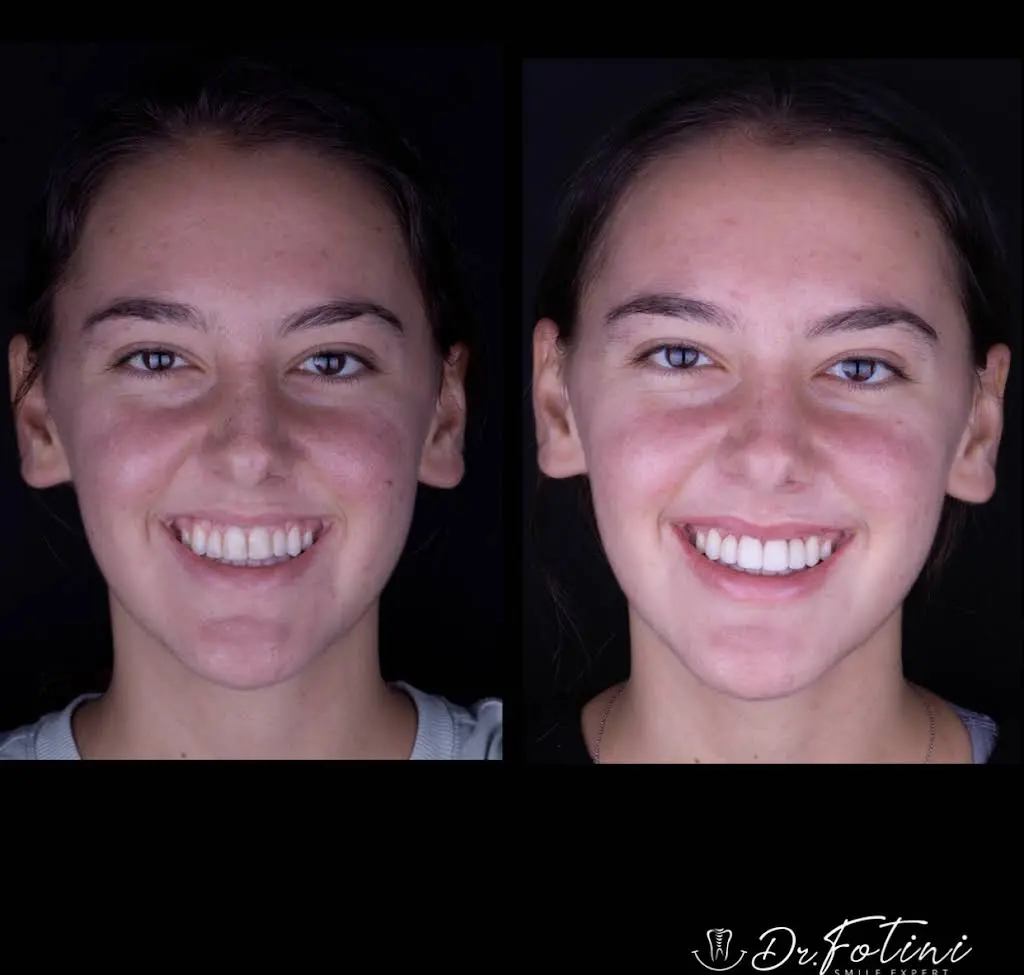 Fotini Chrisopoulos DDS, MS- Prosthodontist | Cosmetic & Implant Dentistry