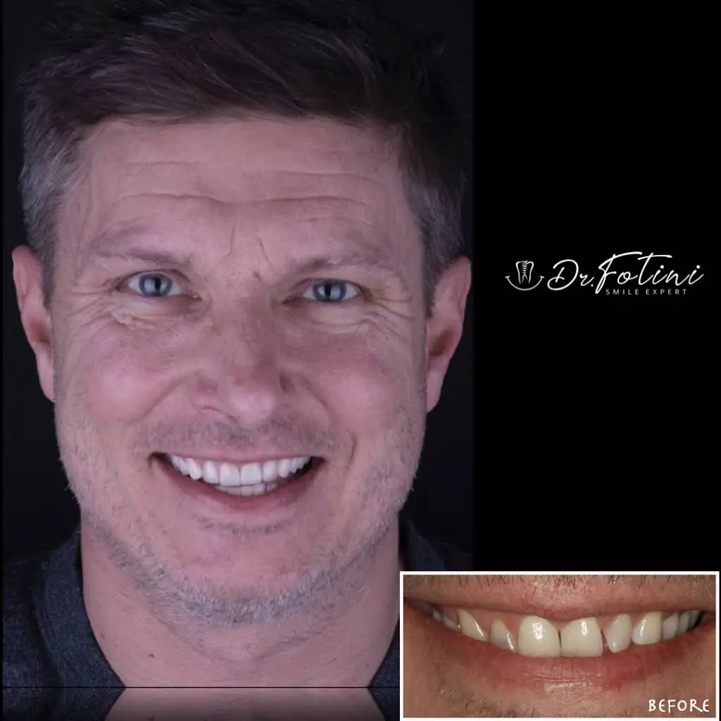 Fotini Chrisopoulos DDS, MS- Prosthodontist | Cosmetic & Implant Dentistry