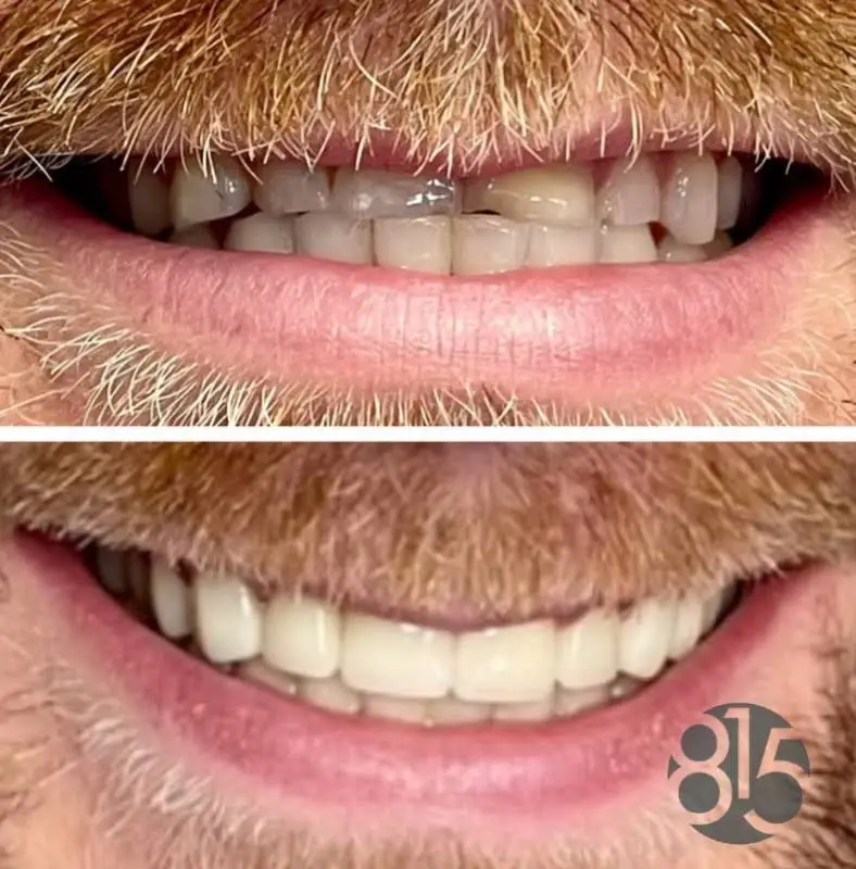 815 Dental Studio - Cherry Valley