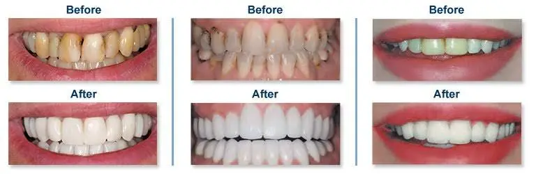 Lindsten Dentistry of Rockford