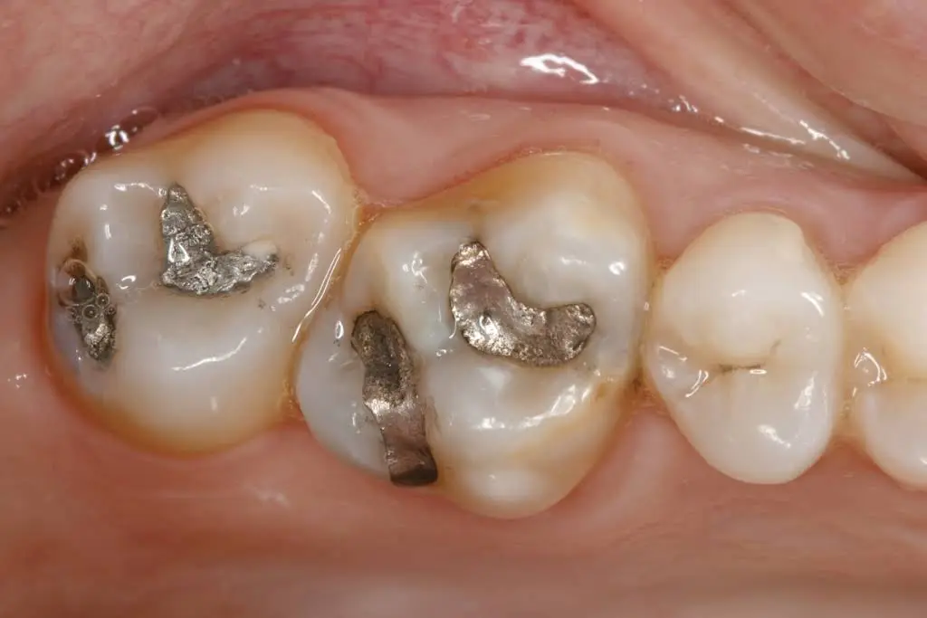 Complete Family Dentistry