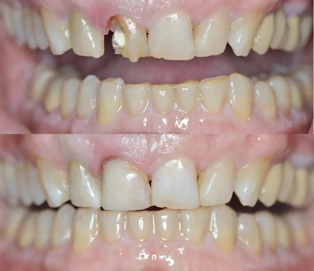 Hillcrest Family Dental
