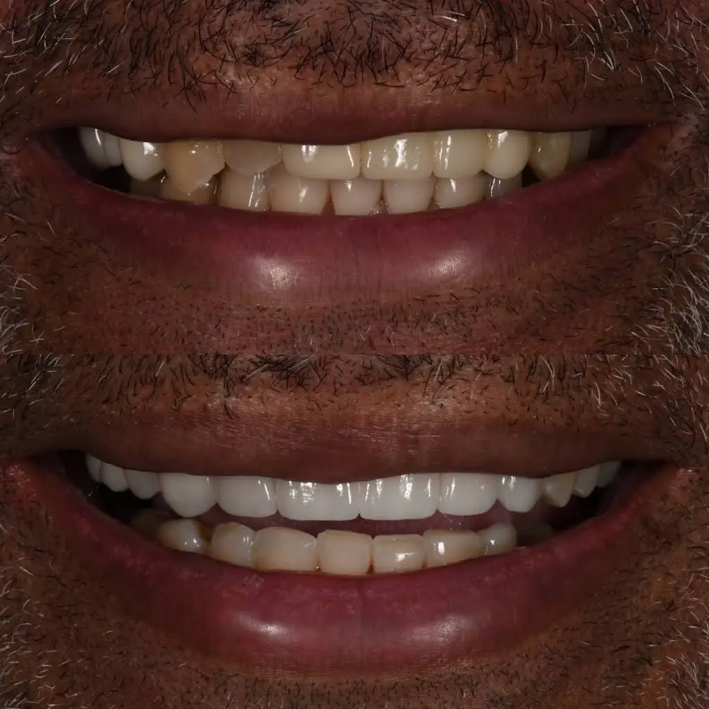 Hillcrest Family Dental
