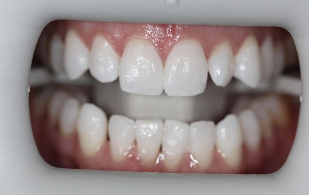 Coral West Dental