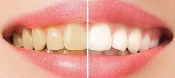 Peterson Family Dental