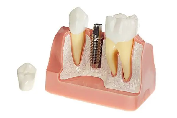 Crossroads Family Dental