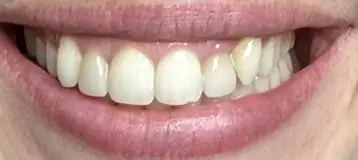 Ulery Dental & Orthodontics