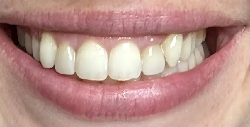 Ulery Dental & Orthodontics