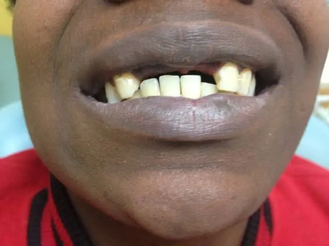 Patrick L. Bryant, DDS General Dentistry
