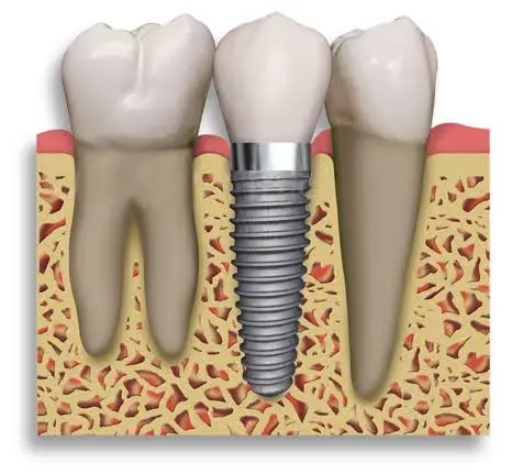 Malcomson Dentistry