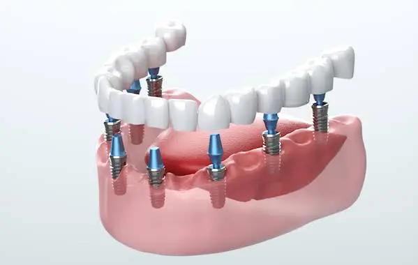 Rockville Dental Arts