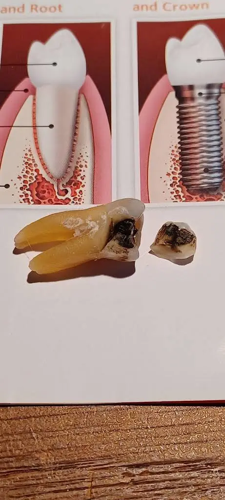 Lorton Dental Implant & Oral Surgery