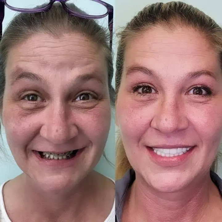 Lorton Dental Implant & Oral Surgery