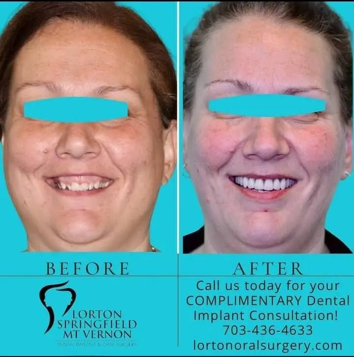 Lorton Dental Implant & Oral Surgery