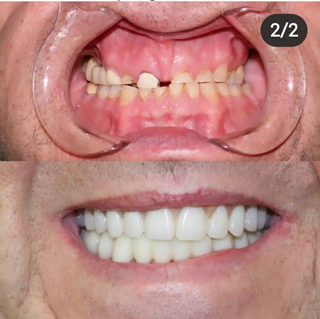Lorton Dental Implant & Oral Surgery