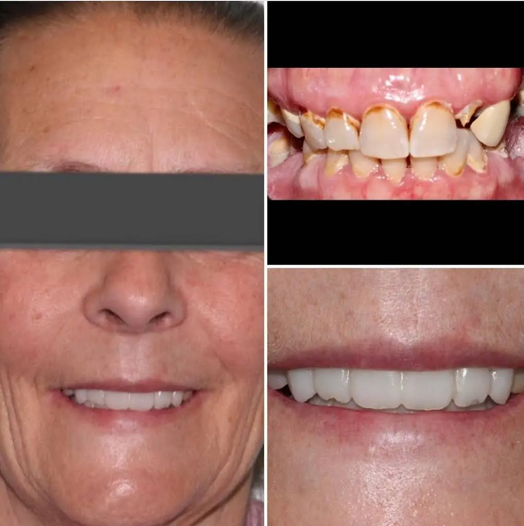Lorton Dental Implant & Oral Surgery