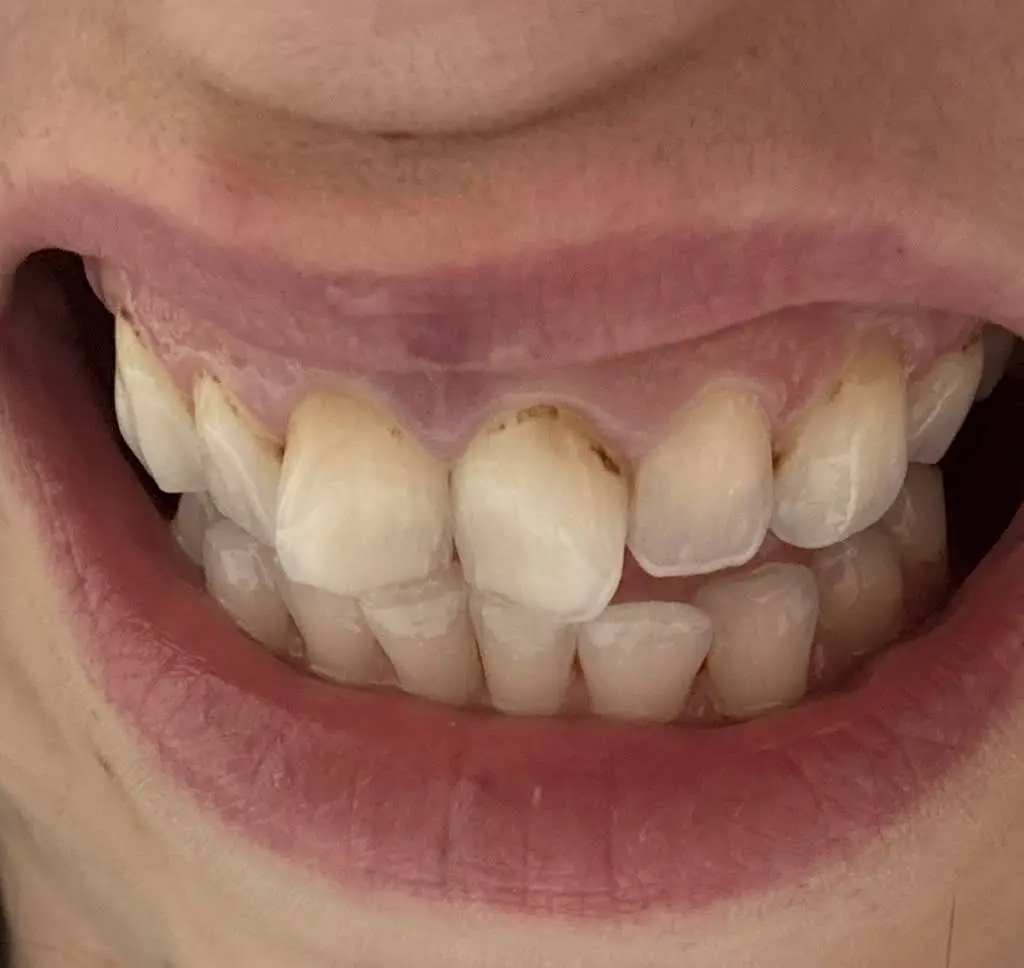 Perryville Dentist