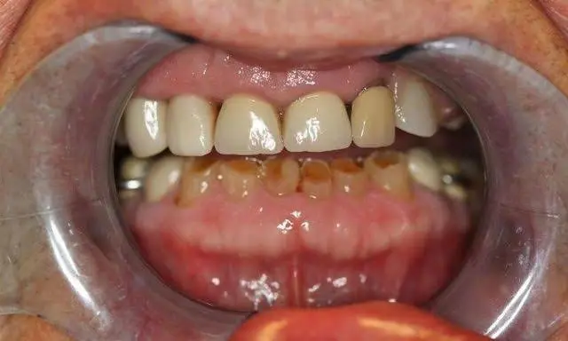 Lake Country Family Dental