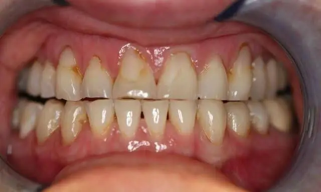 Lake Country Family Dental