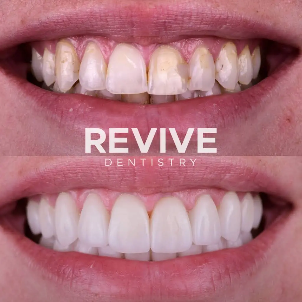 REVIVE Dentistry - Dr. Matt Smith