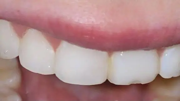 REVIVE Dentistry - Dr. Matt Smith