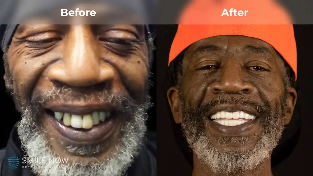 Smile Now Milwaukee Dentures and Implants