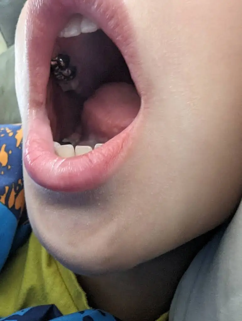 Racine Tooth Town Dentistry for Kids