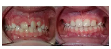 Rea Orthodontics