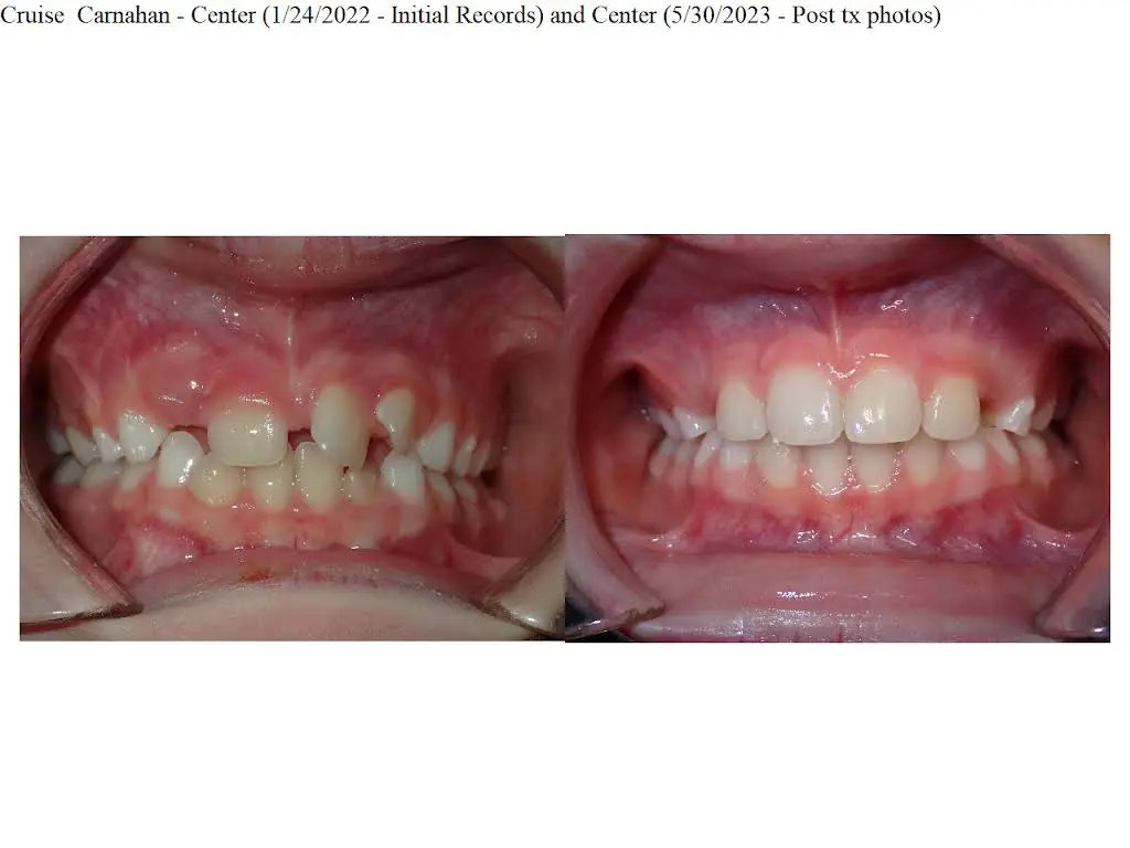 Rea Orthodontics
