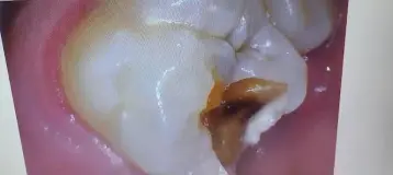 Cornerstone Dental Health