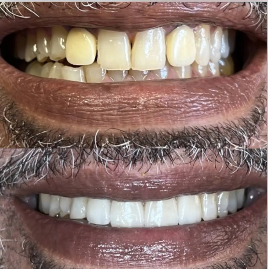 Pearl Smiles Dental