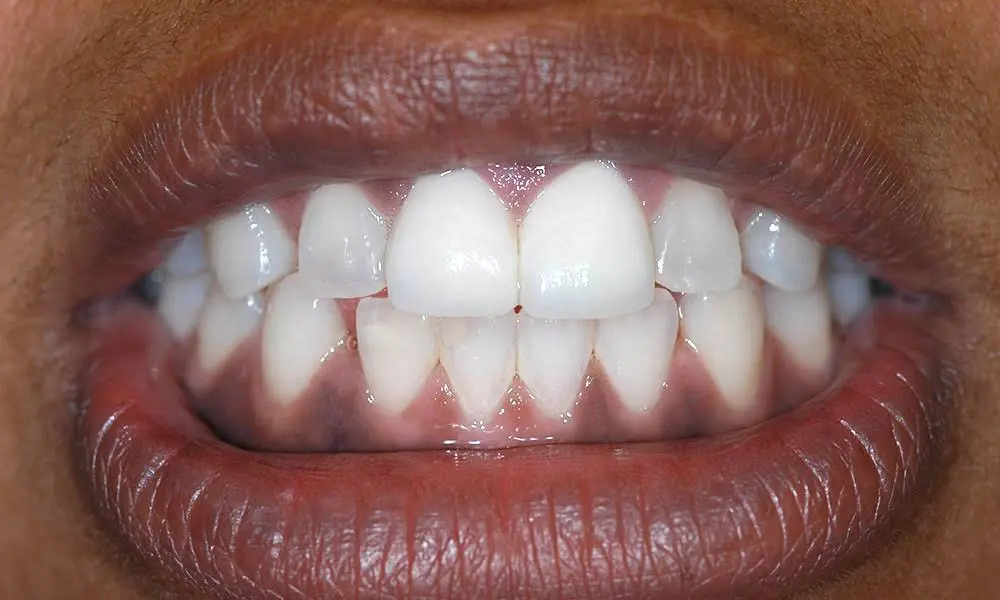 Mazza Center for Implant & Aesthetic Dentistry