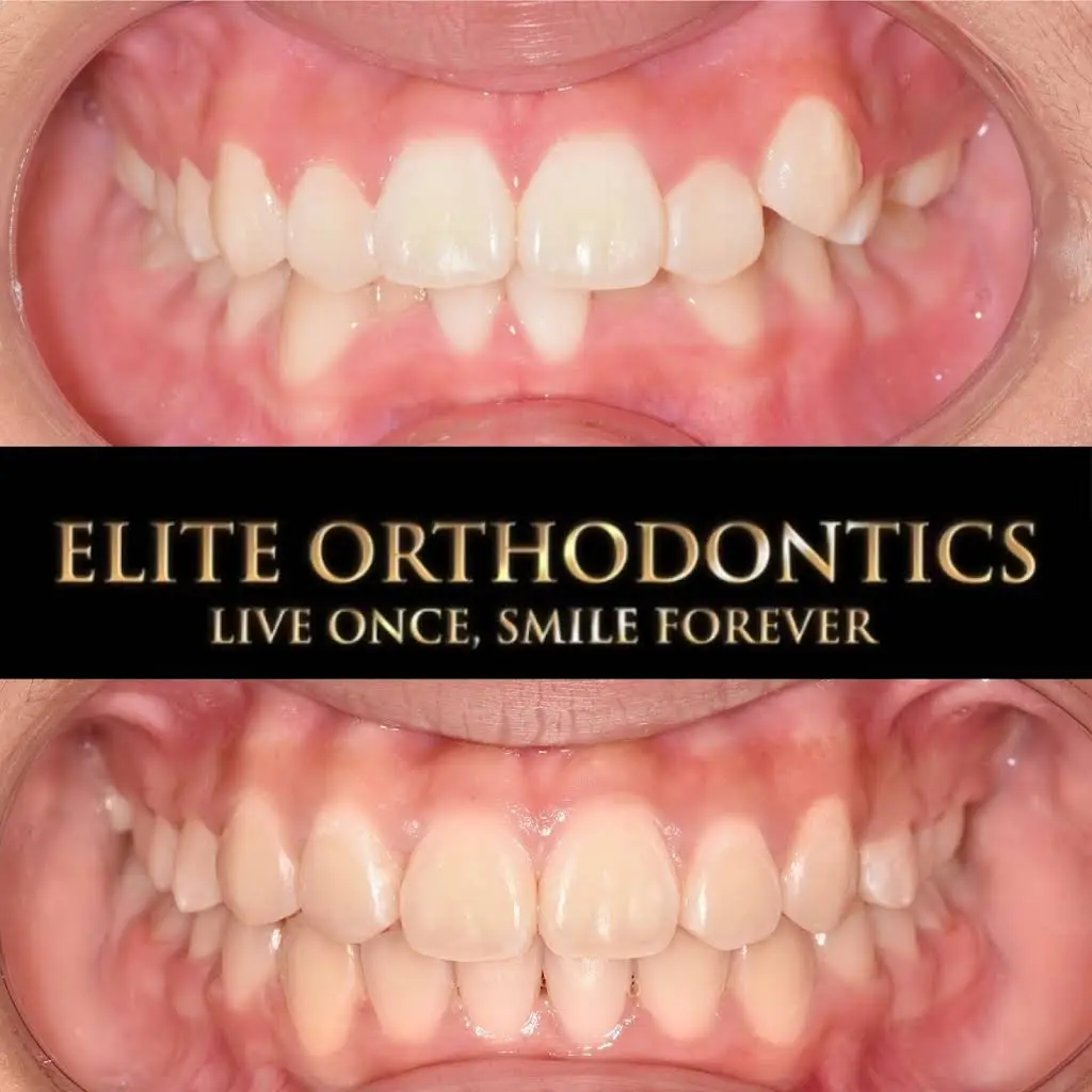 Elite Orthodontics