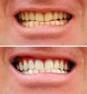 Waldorf Dentistry
