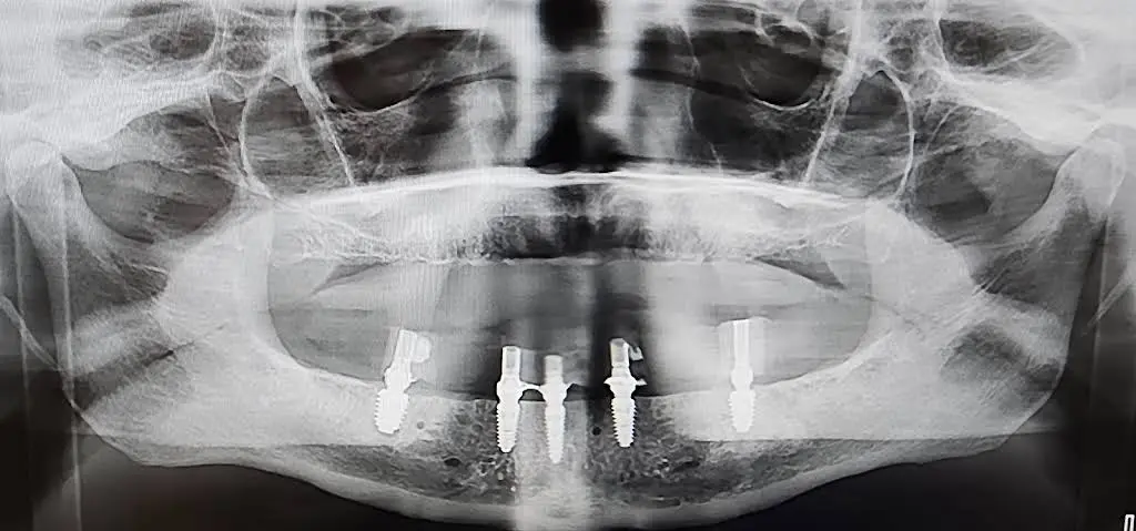 Open Smiles Dental