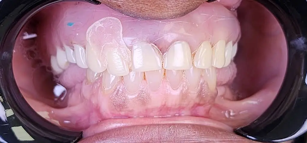 Open Smiles Dental
