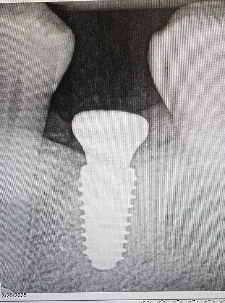 Open Smiles Dental