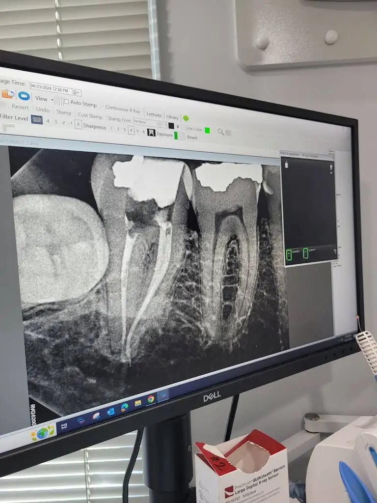 Access Endodontics