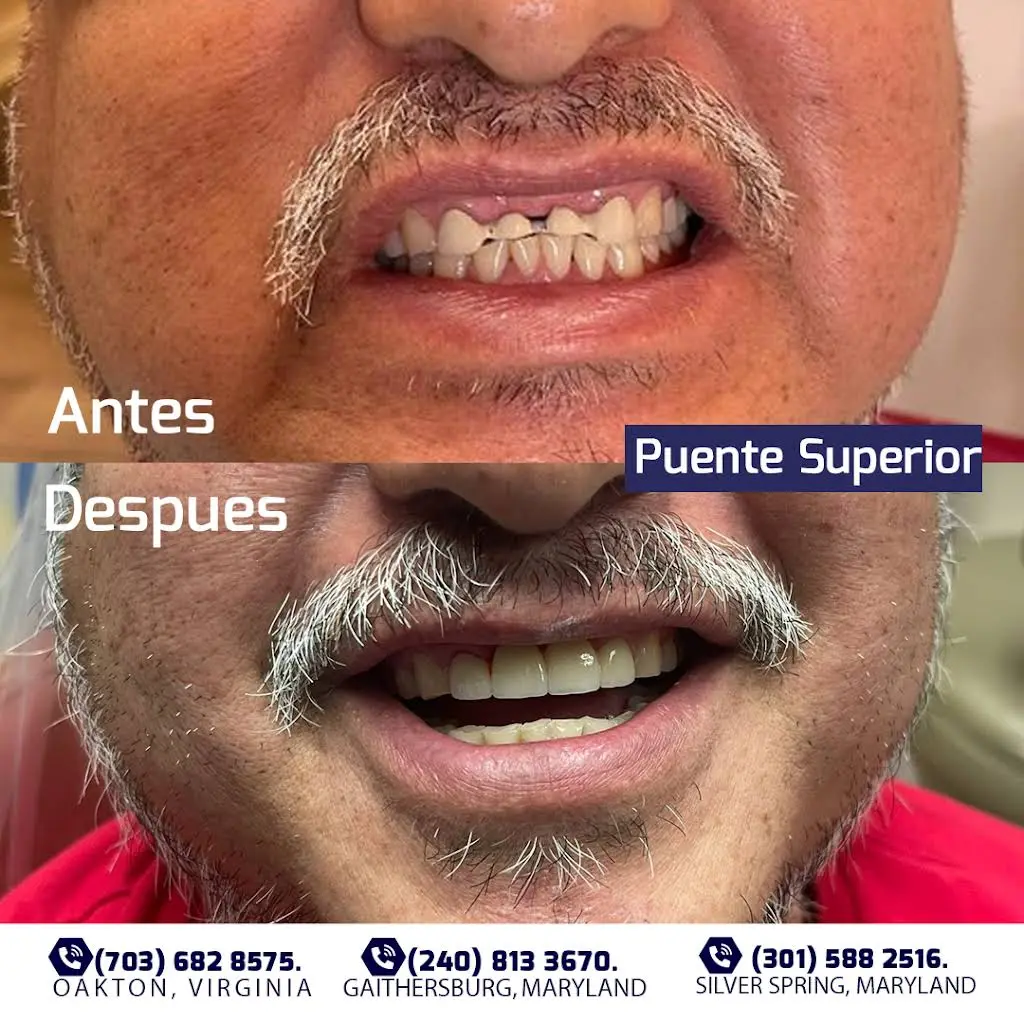 Servicios Dentales Hispanos