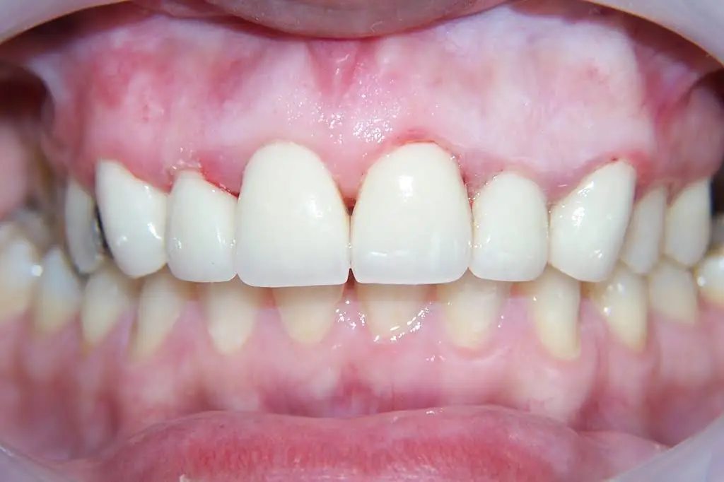 Aesthetic Family Dental & Implant Center