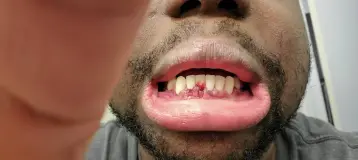 Waldorf Periodontics and Implants