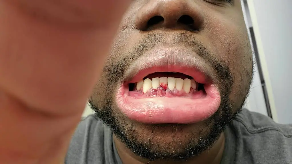 Waldorf Periodontics and Implants