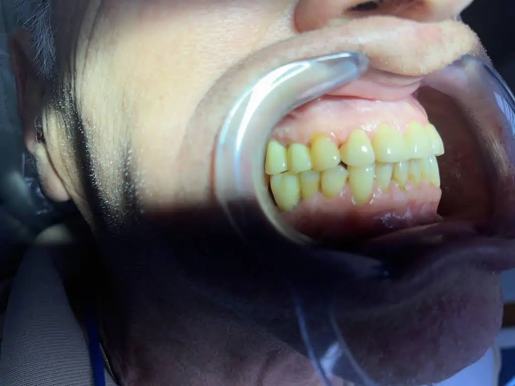 Waldorf Periodontics and Implants