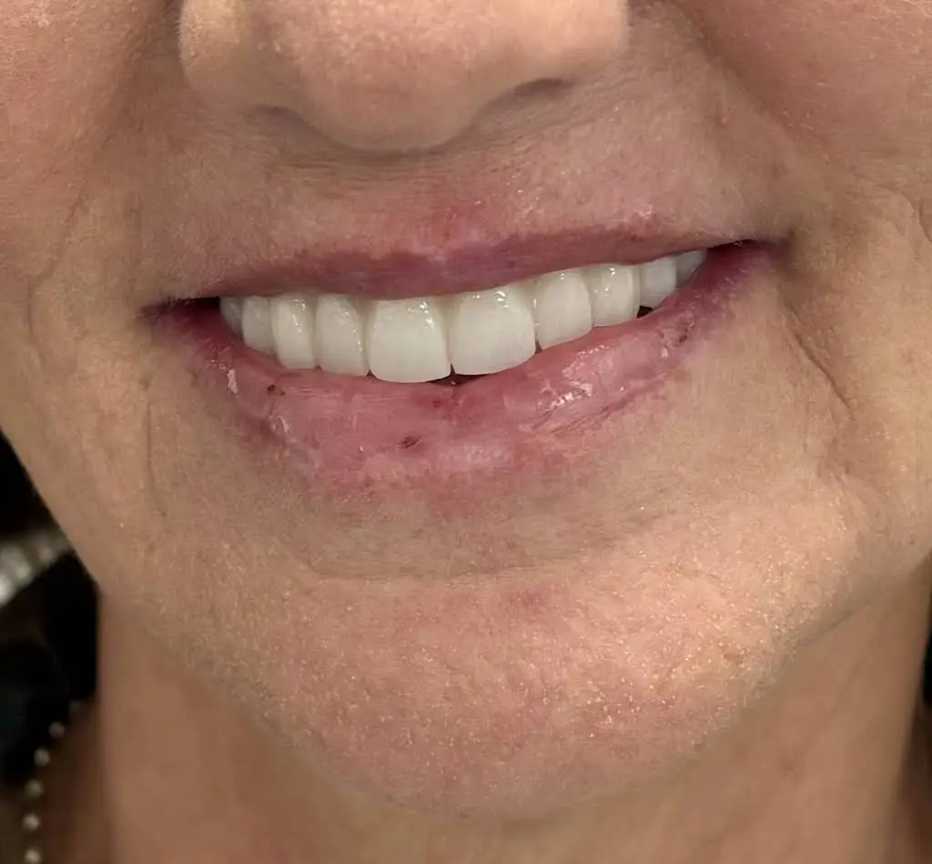 Waldorf Periodontics and Implants
