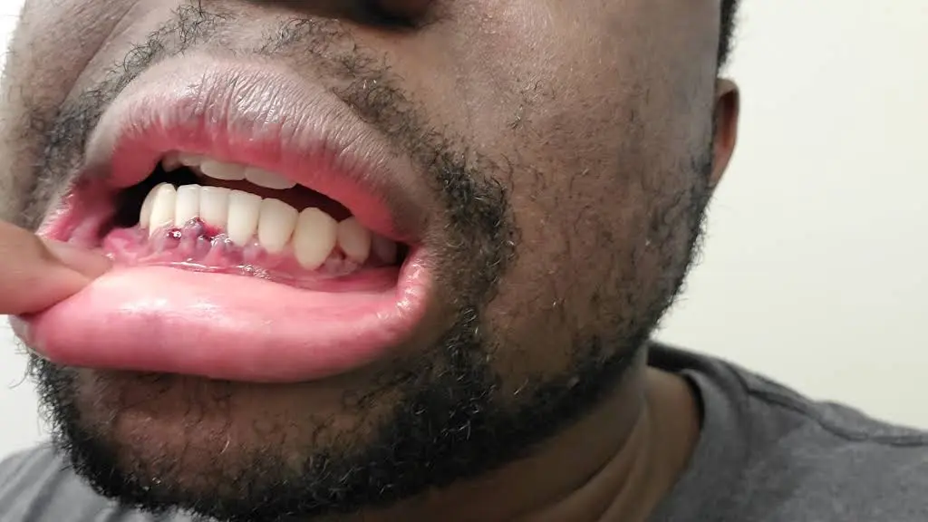 Waldorf Periodontics and Implants