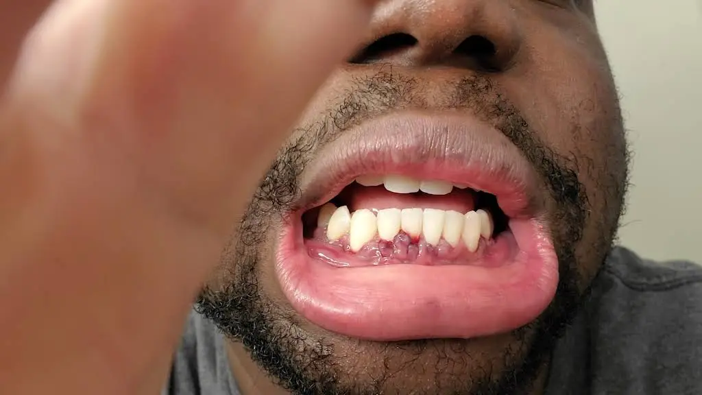 Waldorf Periodontics and Implants