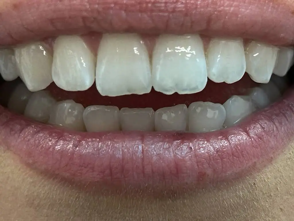 Dental Care of Waldorf
